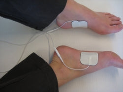 How Microcurrent Therapy Unlocks Faster Wound Healing