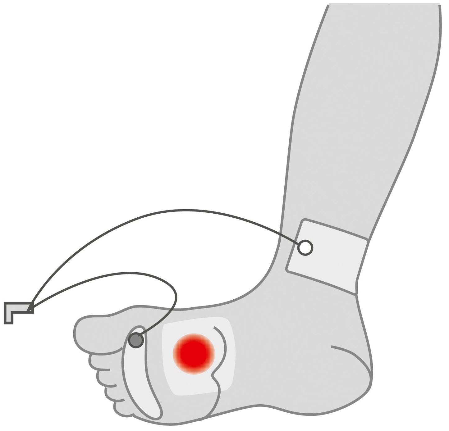 Diabetic Foot Ulcer: Care, Management, and Supportive Approaches
